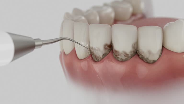 Trusted Teeth Cleaning And Checkup service in West Wyoming, PA - Dentist Open Now